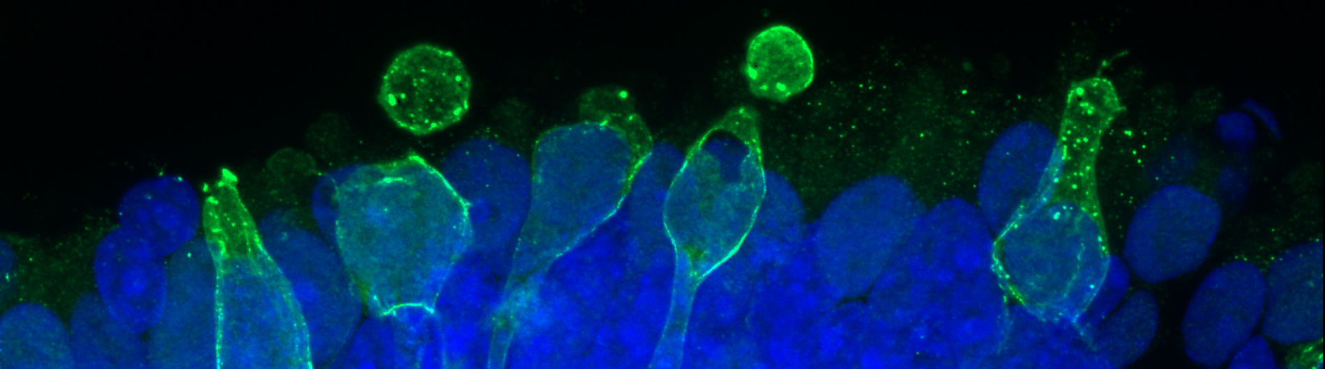 The fight against blindness